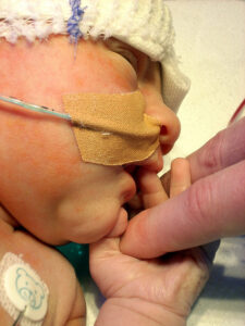 Neonatal Intensive Care Unit (NICU) Tips