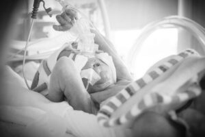 Medical Malpractice and the NICU (Neonatal Intensive Care Unit)