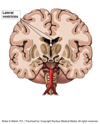 lateral ventricles of the brain