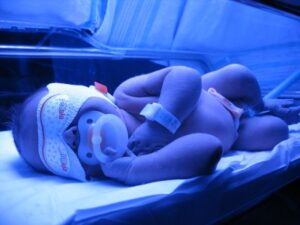 jaundice and neonatal seizures