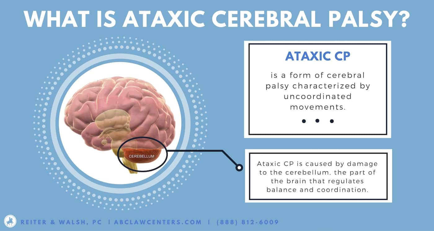 Ataxic Cerebral Palsy brain diagram identifying cerebellum damage