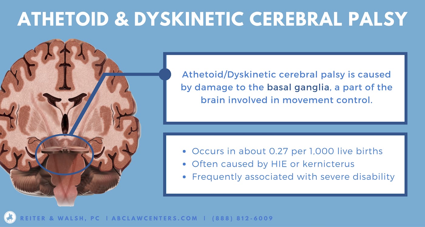 Athetoid-dyskinetic cerebral palsy brain diagram