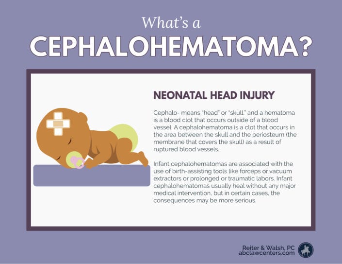 Cephalohematoma neonatal head injury