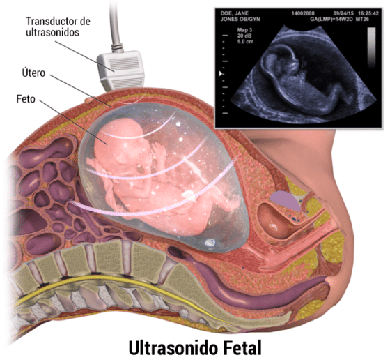 ultrasonido fetal