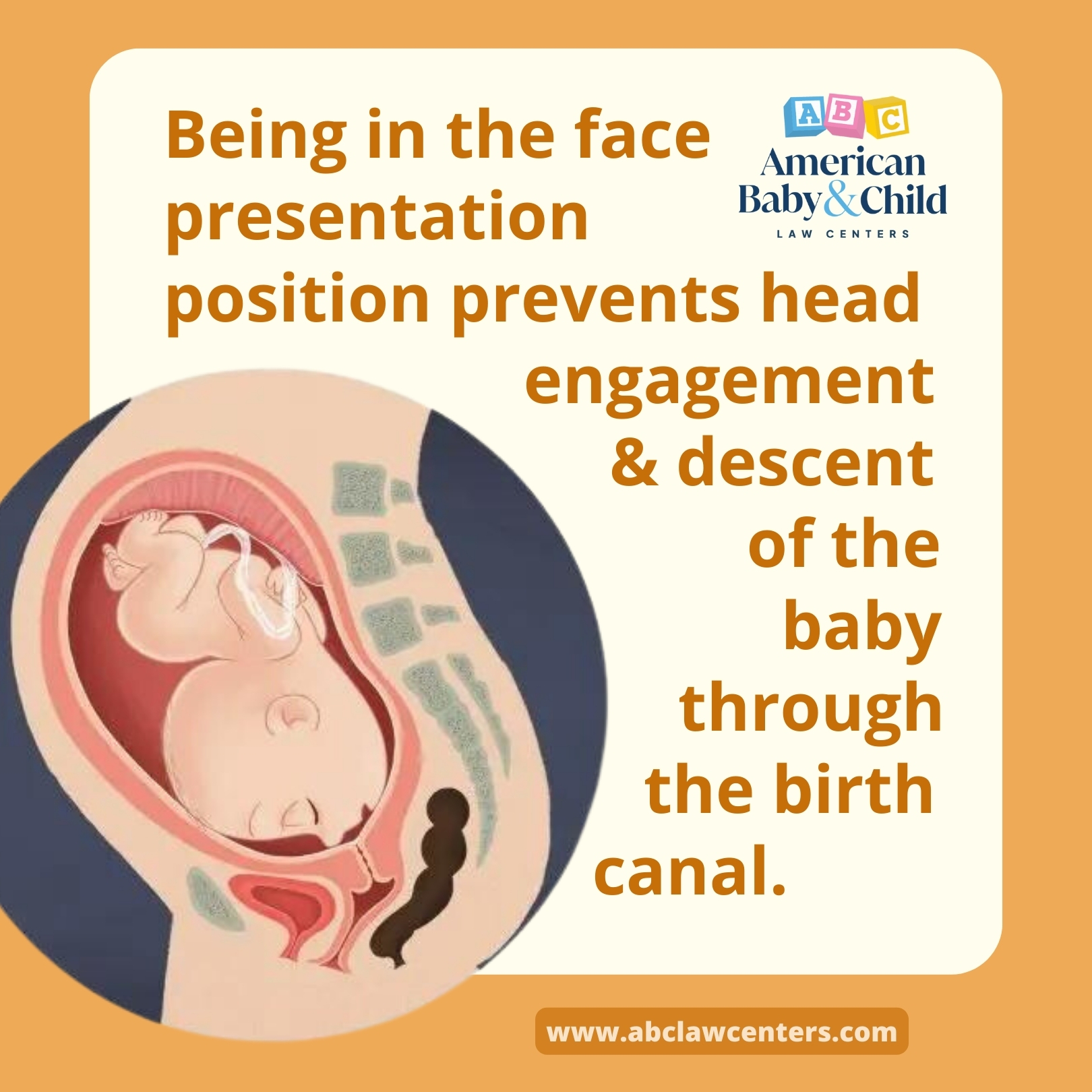 Baby in utero in face presentation.