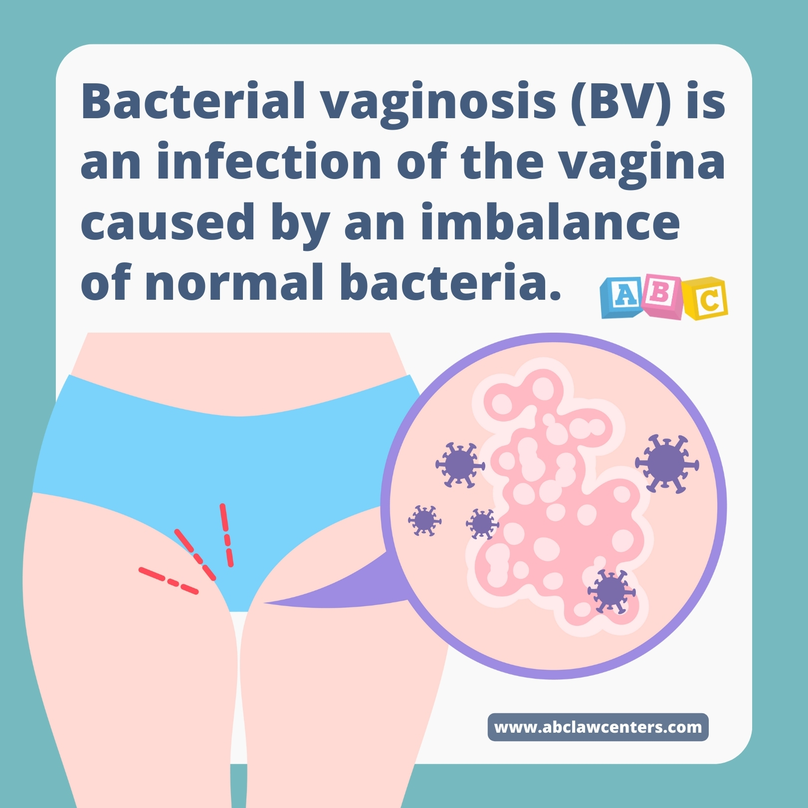 Vaginal bacterial infection