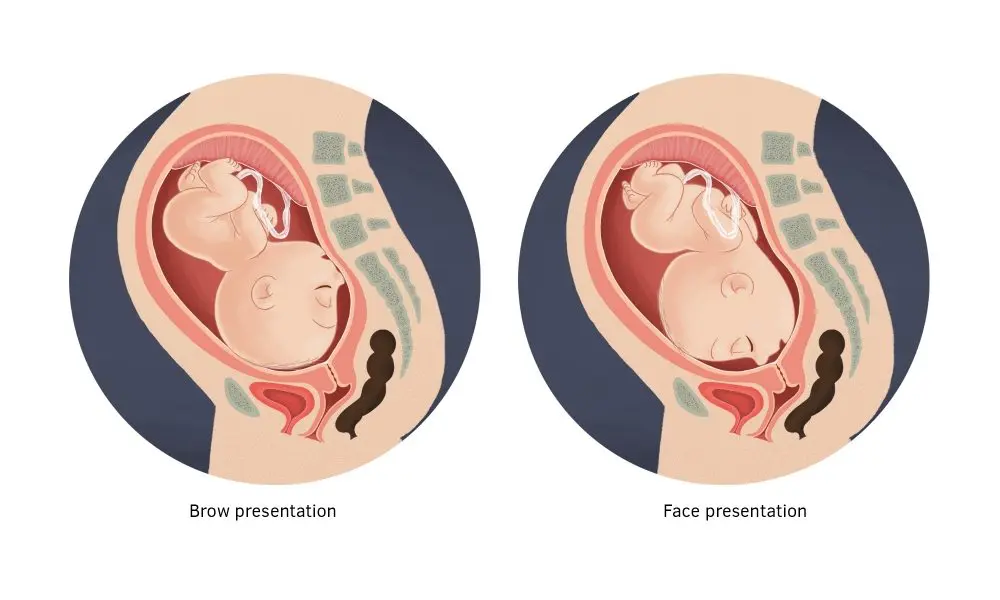 face presentation define medical