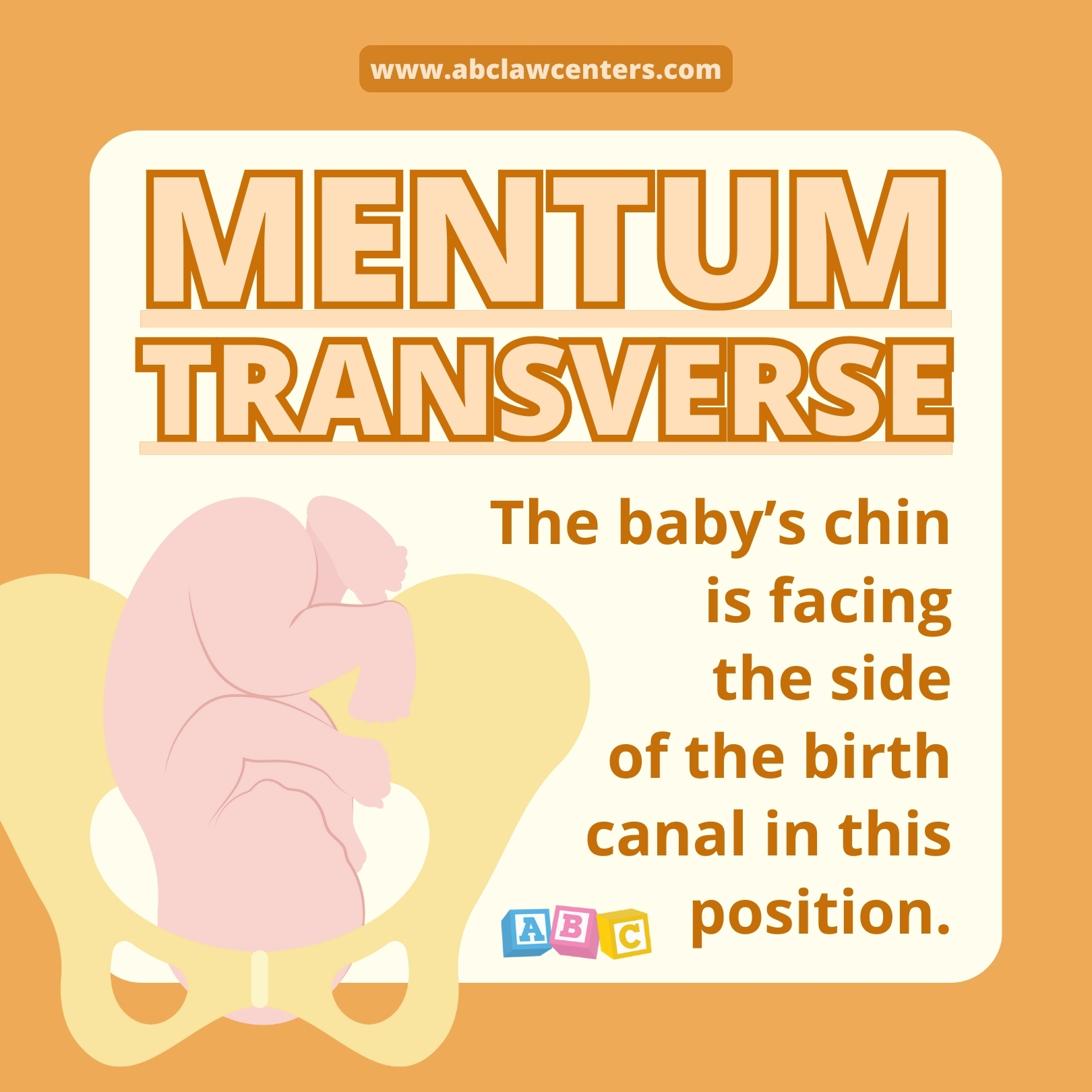 Baby facing sideways in pelvis / birth canal.