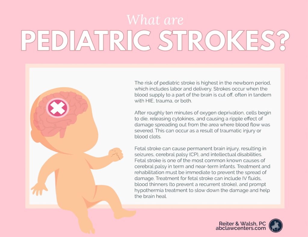 Fetal Stroke Strokes in Utero Fetal Stroke Attorneys & Lawyers
