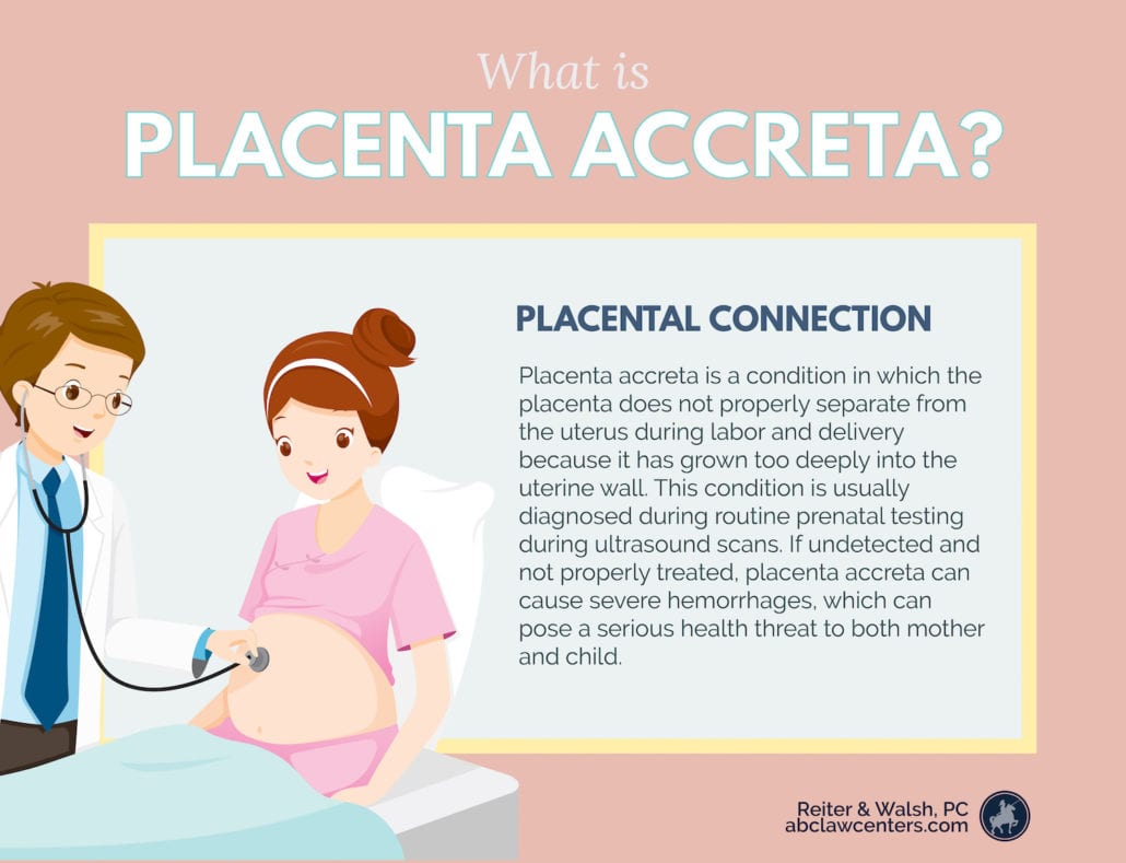 what is placenta accreta