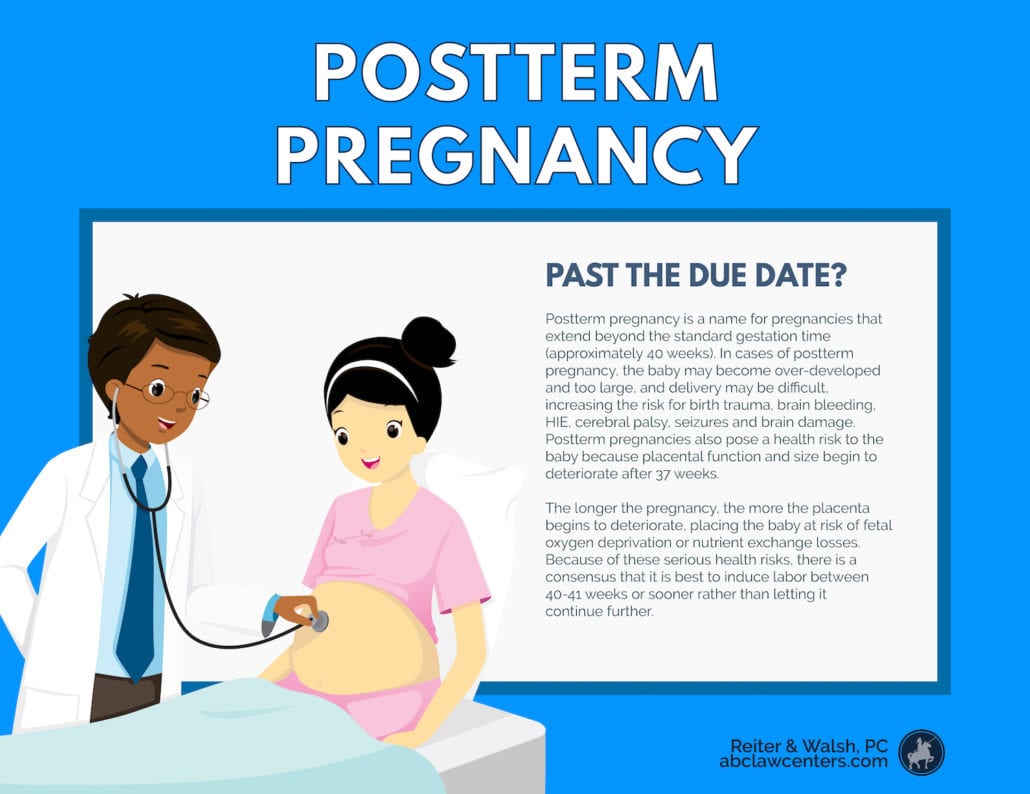postterm pregnancy