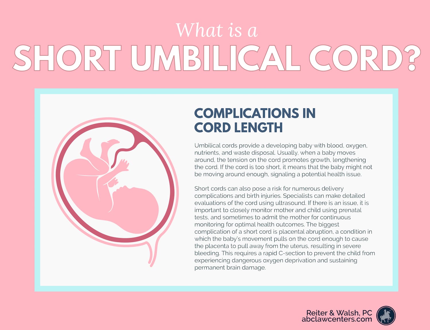 What is a Short Umbilical Cord - Complications in cord length