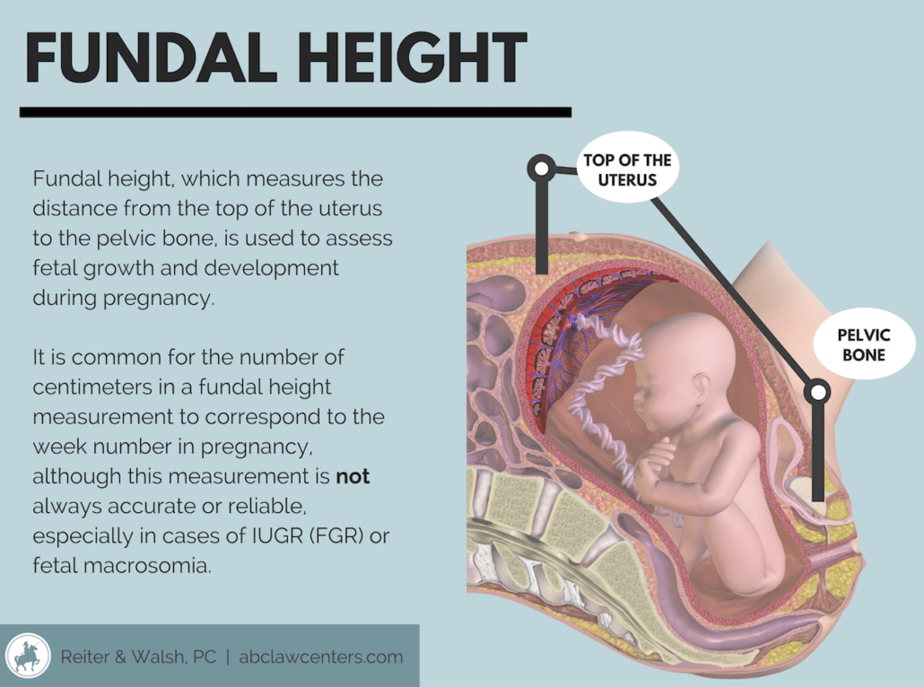 Fundal Height Infographic