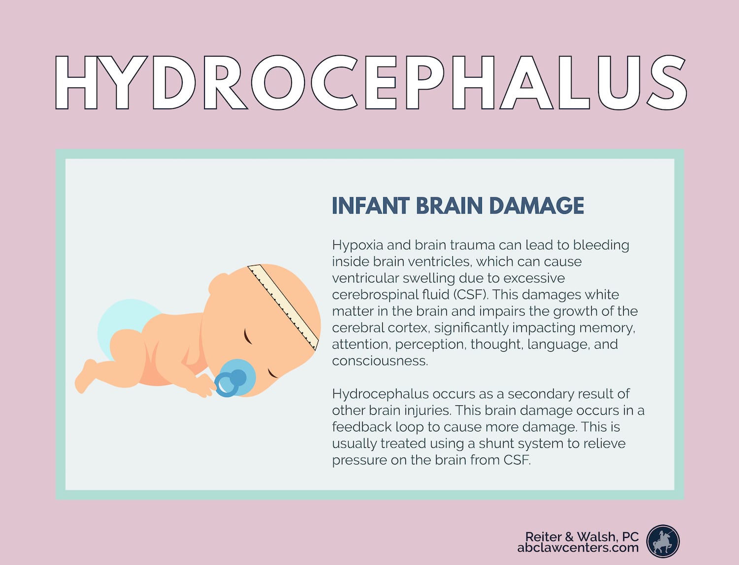 Hydrocephalus in babies