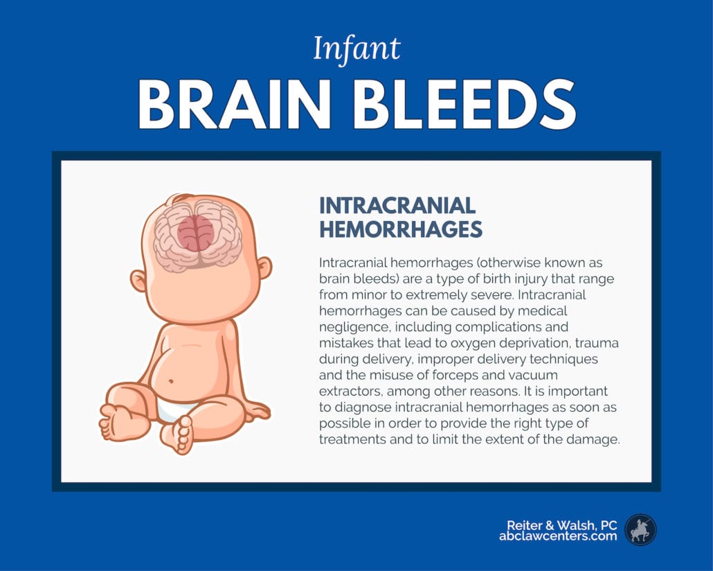 signs of infant brain bleeds