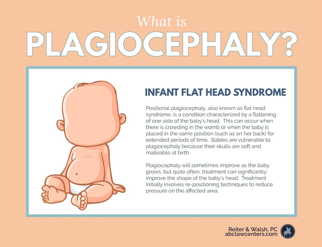 plagiocephaly flat head syndrome