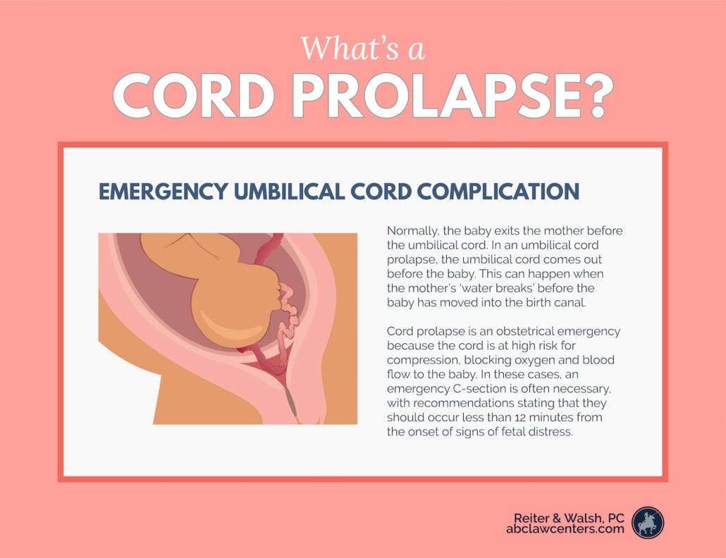 umbilical cord prolapse