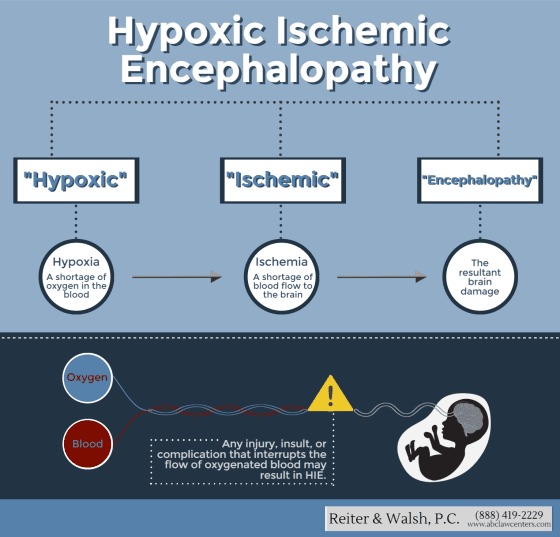 (HIE) Hypoxic Ischemic Encephalopathy Definition | Infographic