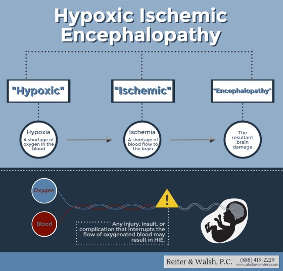 Hypoxic-Ischemic Encephalopathy - Infographics and Images